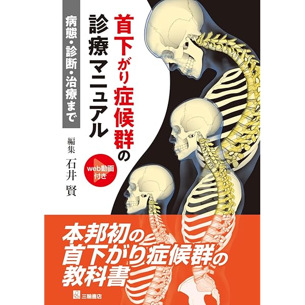Amazon.co.jp: 小児脊柱変形治療の最前線 : 日本側彎症学会: 本